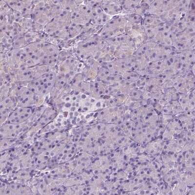 Immunohistochemistry-Paraffin: KCC2/SLC12A5 Antibody [NBP2-49674]