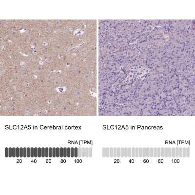 Immunohistochemistry-Paraffin: KCC2/SLC12A5 Antibody [NBP2-49674]