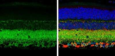 Immunohistochemistry-Paraffin: KCC2/SLC12A5 Antibody [NBP3-13161]