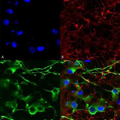 Immunocytochemistry/ Immunofluorescence: KCC2/SLC12A5 Antibody (S1-12) [NBP2-59337]