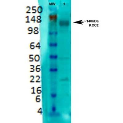 Western Blot: KCC2/SLC12A5 Antibody (S1-12) [NBP2-59337]