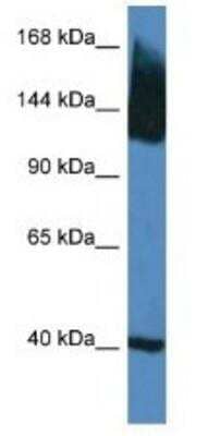 Western Blot: KCC2/SLC12A5 Antibody [NBP1-74063]