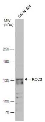 Western Blot: KCC2/SLC12A5 Antibody [NBP3-13161]