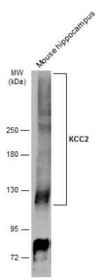 Western Blot: KCC2/SLC12A5 Antibody [NBP3-13161]