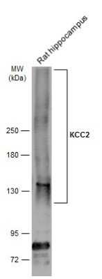 Western Blot: KCC2/SLC12A5 Antibody [NBP3-13161]