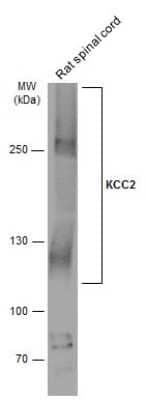 Western Blot: KCC2/SLC12A5 Antibody [NBP3-13161]