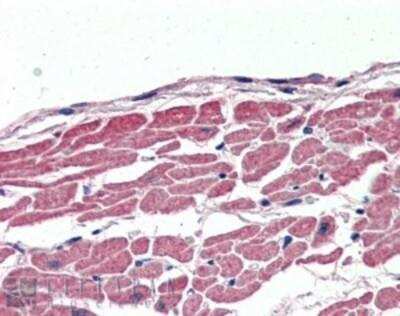 Immunohistochemistry-Paraffin: KCC3/SLC12A6 Antibody [NBP1-06044]