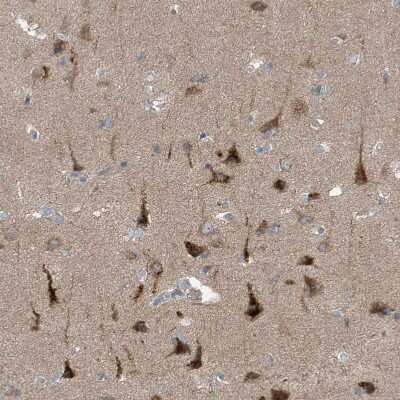 Immunohistochemistry-Paraffin: KCC3/SLC12A6 Antibody [NBP1-89282]