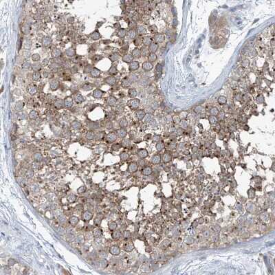 Immunohistochemistry-Paraffin: KCC3/SLC12A6 Antibody [NBP1-89282]