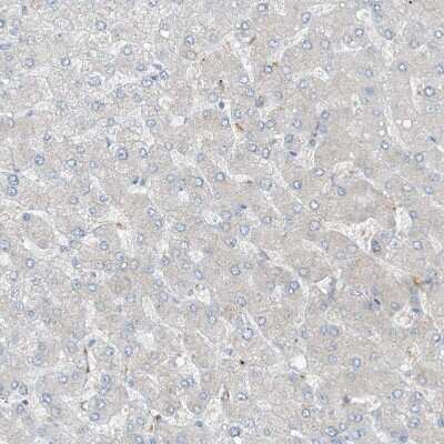 Immunohistochemistry-Paraffin: KCC3/SLC12A6 Antibody [NBP1-89282]