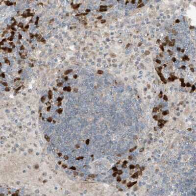 Immunohistochemistry-Paraffin: KCC3/SLC12A6 Antibody [NBP1-89282]