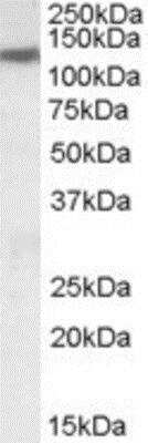 Western Blot: KCC3/SLC12A6 Antibody [NBP1-06044]