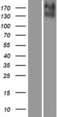 Western Blot: KCC4/SLC12A7 Overexpression Lysate [NBP2-10402]