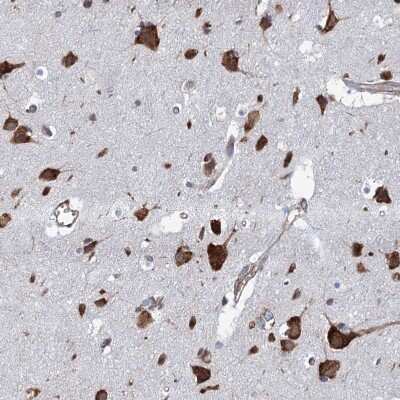 Immunohistochemistry-Paraffin: KCC4/SLC12A7 Antibody [NBP1-85133]