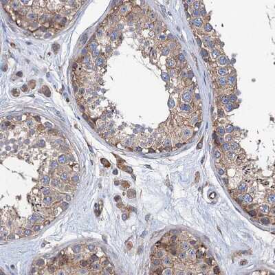 Immunohistochemistry-Paraffin: KCC4/SLC12A7 Antibody [NBP1-85133]