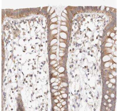 Immunohistochemistry-Paraffin: KCMF1 Antibody [NBP1-84283]