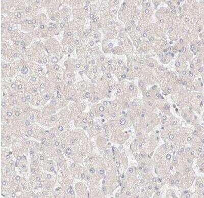 Immunohistochemistry-Paraffin: KCMF1 Antibody [NBP1-84283]