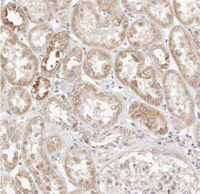 Immunohistochemistry-Paraffin: KCMF1 Antibody [NBP1-84283]