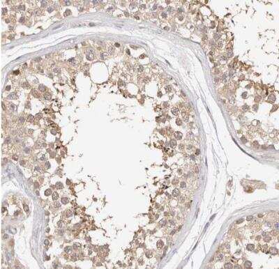 Immunohistochemistry-Paraffin: KCMF1 Antibody [NBP1-84283]