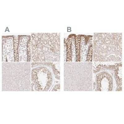 Immunohistochemistry-Paraffin: KCMF1 Antibody [NBP1-84283]