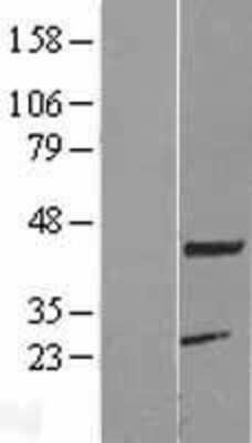 Western Blot: KCMF1 Overexpression Lysate [NBL1-12136]