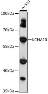 Western Blot: KCNA10 AntibodyAzide and BSA Free [NBP3-04425]