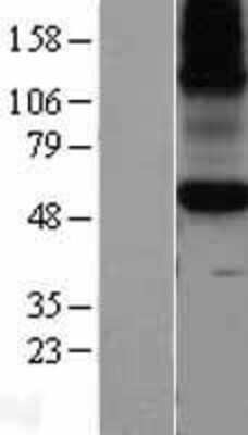 Western Blot: KCNA10 Overexpression Lysate [NBL1-12138]