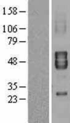 Western Blot: KCNA7 Overexpression Lysate [NBL1-12140]