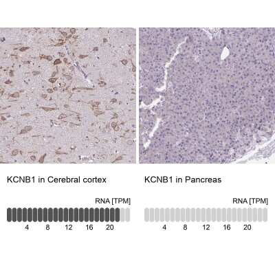 Immunohistochemistry-Paraffin: KCNB1 Antibody [NBP2-38498]