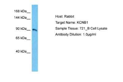 Western Blot: KCNB1 Antibody [NBP2-83102]