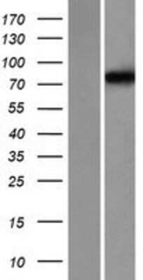 Western Blot: Kv3.3 Overexpression Lysate [NBP2-07805]