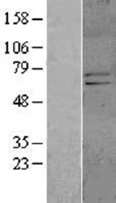 Western Blot: Kv4.1 Overexpression Lysate [NBL1-12145]