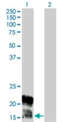 Western Blot: KCNE1 Antibody (5B12) [H00003753-M01]
