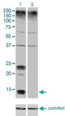 Western Blot: KCNE1 Antibody (5B12) [H00003753-M01]