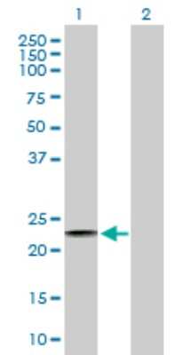 Western Blot: KCNE1 Antibody [H00003753-B01P]