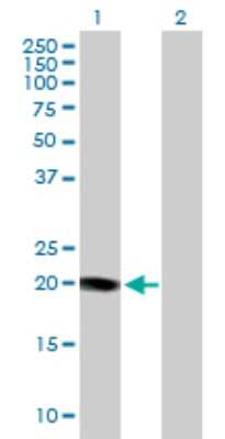 Western Blot: KCNE1 Antibody [H00003753-D01P]