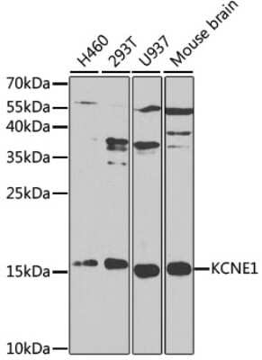 Western Blot: KCNE1 AntibodyBSA Free [NBP3-03910]