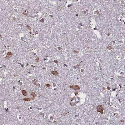 Immunohistochemistry-Paraffin: KCNE1-like Antibody [NBP1-85835]