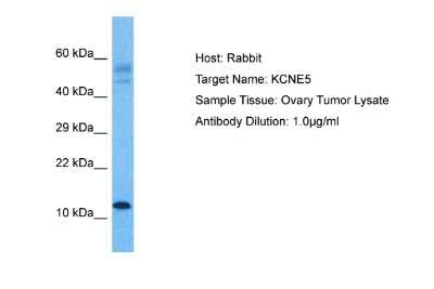 Western Blot: KCNE1-like Antibody [NBP2-83103]