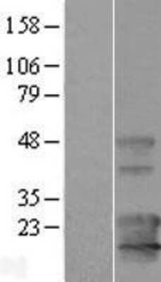 Western Blot: KCNE1-like Overexpression Lysate [NBL1-12148]