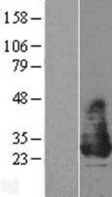 Western Blot: MiRP1 Overexpression Lysate [NBL1-12149]