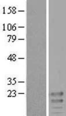 Western Blot: MiRP2 Overexpression Lysate [NBL1-12150]