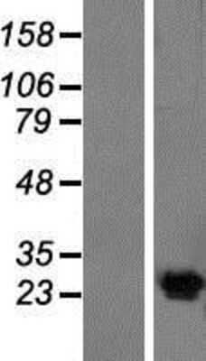 Western Blot: Kv6.4 Overexpression Lysate [NBP2-09968]