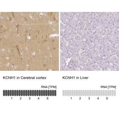 Immunohistochemistry-Paraffin: KCNH1 Antibody [NBP1-84935]