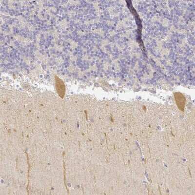 Immunohistochemistry-Paraffin: KCNH1 Antibody [NBP1-84935]