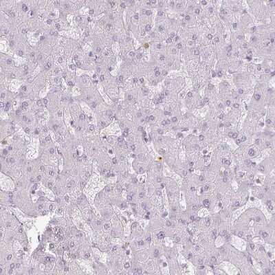 Immunohistochemistry-Paraffin: KCNH1 Antibody [NBP1-84935]