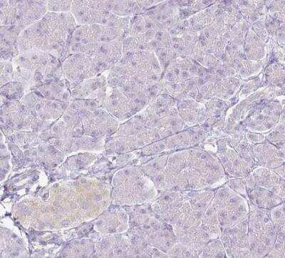 Immunohistochemistry-Paraffin: KCNH1 Antibody [NBP1-84935]