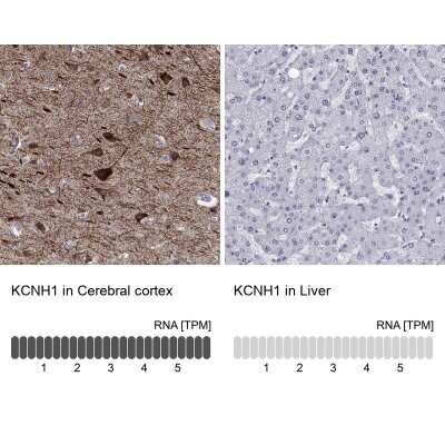 Immunohistochemistry-Paraffin: KCNH1 Antibody [NBP3-17103]