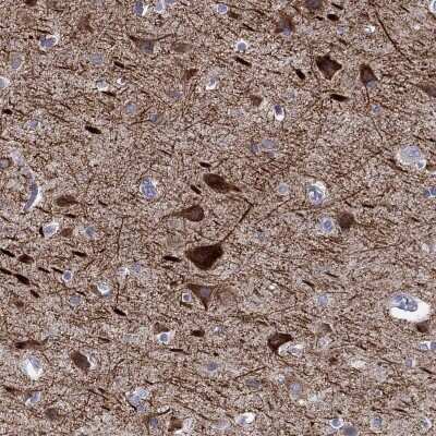 Immunohistochemistry-Paraffin: KCNH1 Antibody [NBP3-17103]