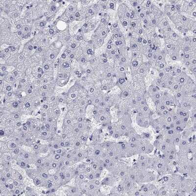 Immunohistochemistry-Paraffin: KCNH1 Antibody [NBP3-17103]